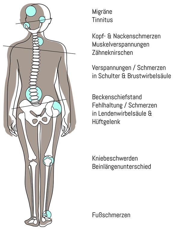 CMD: Kiefer- oder Kopfschmerzen in Mönchengladbach?